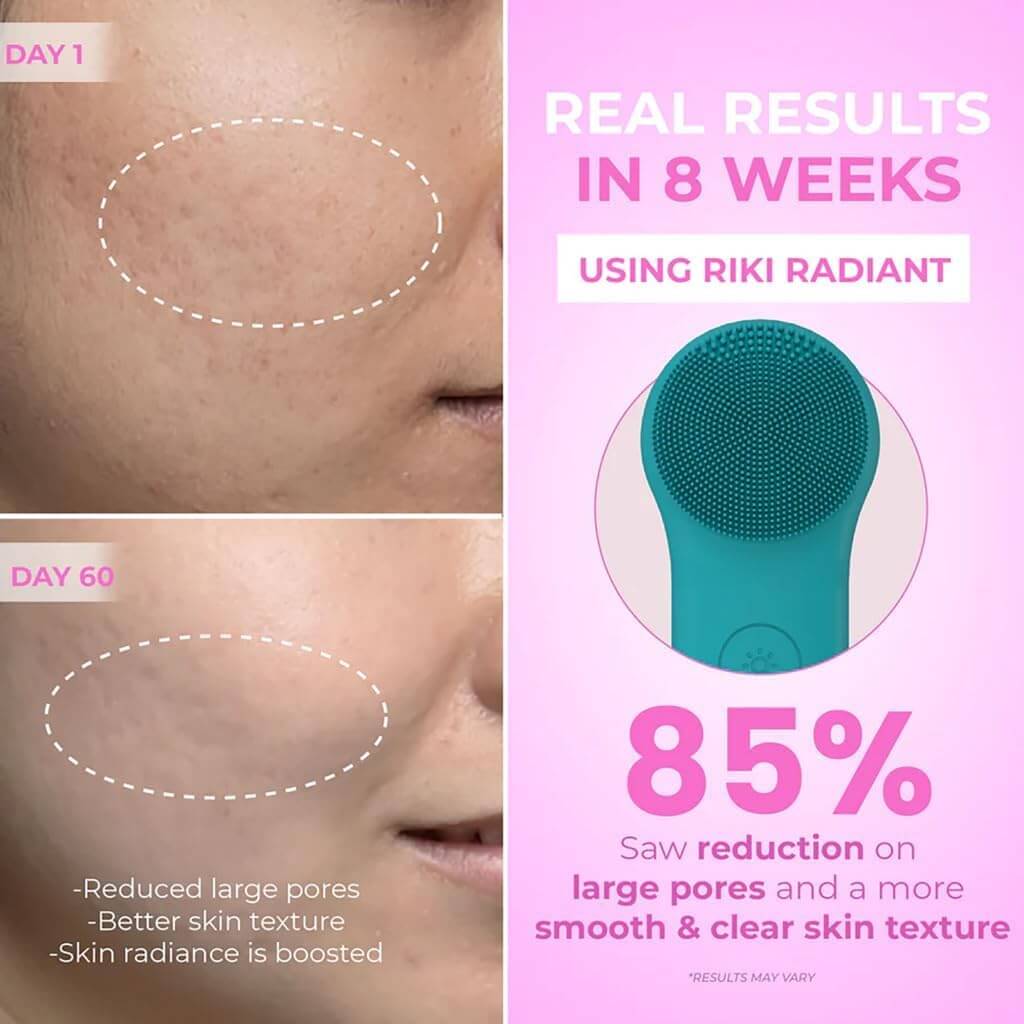 Medivita 2-in-1 Elektrische Silicone Gezichtsontstopper