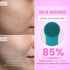 Medivita 2-in-1 Elektrische Silicone Gezichtsontstopper